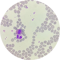 Classic Wright-Giemsa Fuccillo Stain Circle