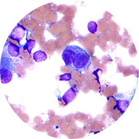 Romanowsky staining chemistry circle