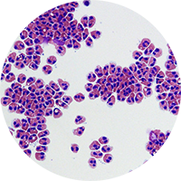 White Blood Differentials