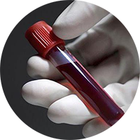 blood sample circle-1