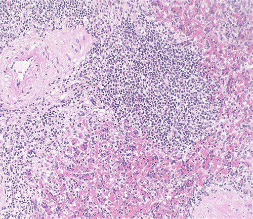 How to Improve Nuclear Staining in Histology Slides