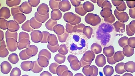 Improve the Definition & Intensity of a Wright's or Wright-Giemsa Stain