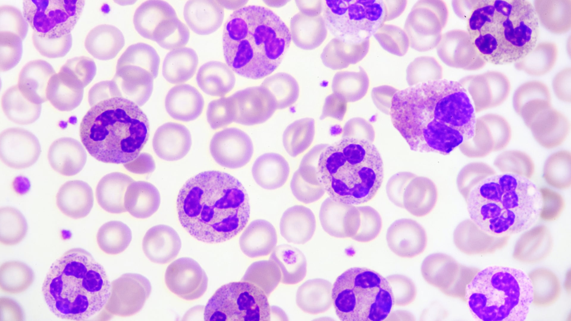Why Buffer pH Can Be Inconsistent and How It Affects Blood Smear Staining