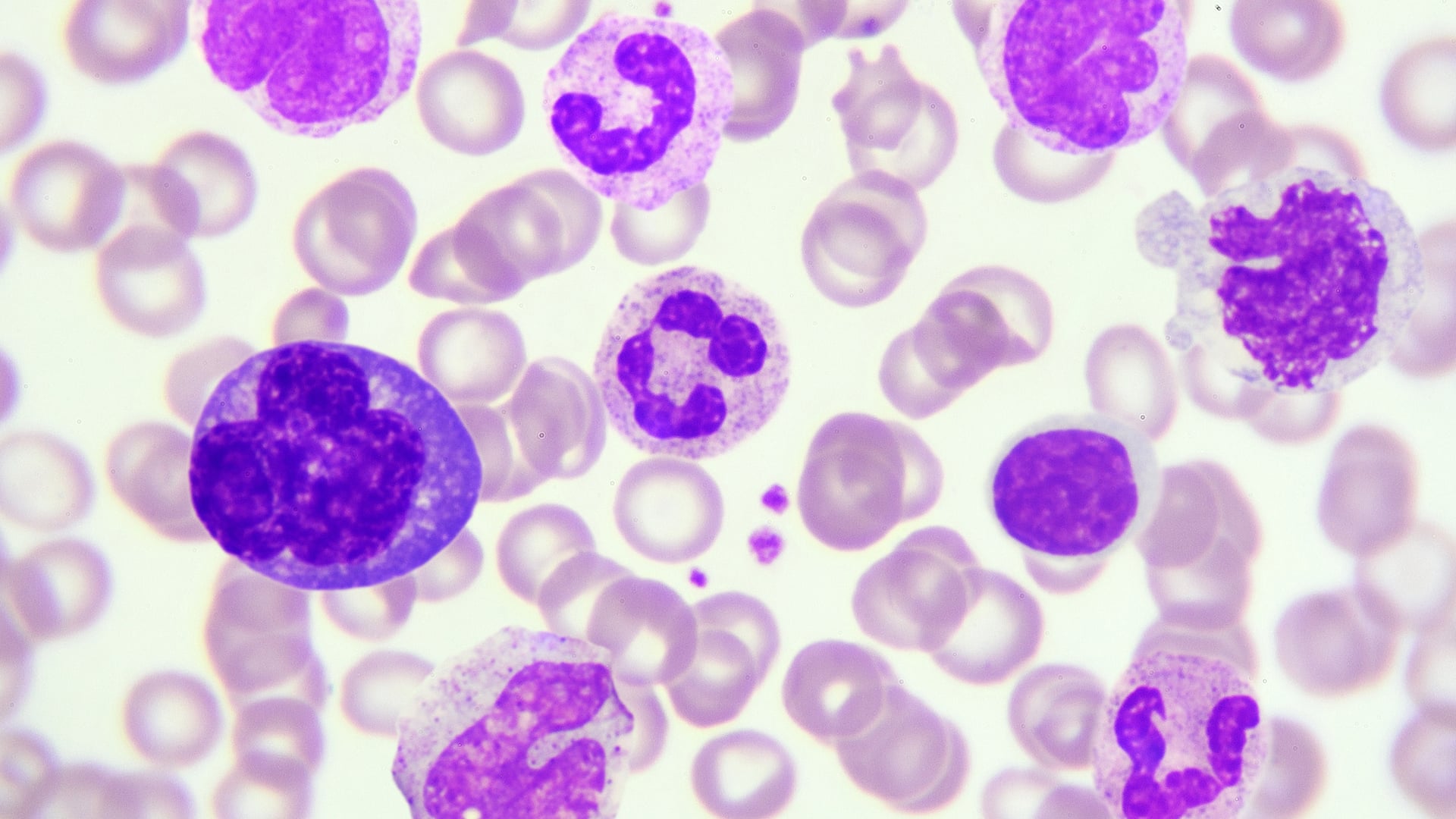 Inconsistent Blood Smear Stains? How Buffer pH Can Make or Break Your Results