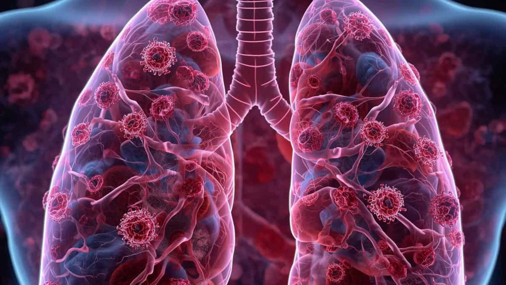 Infiltration of Tissue Plus Superior Sectioning Ability: WHY?