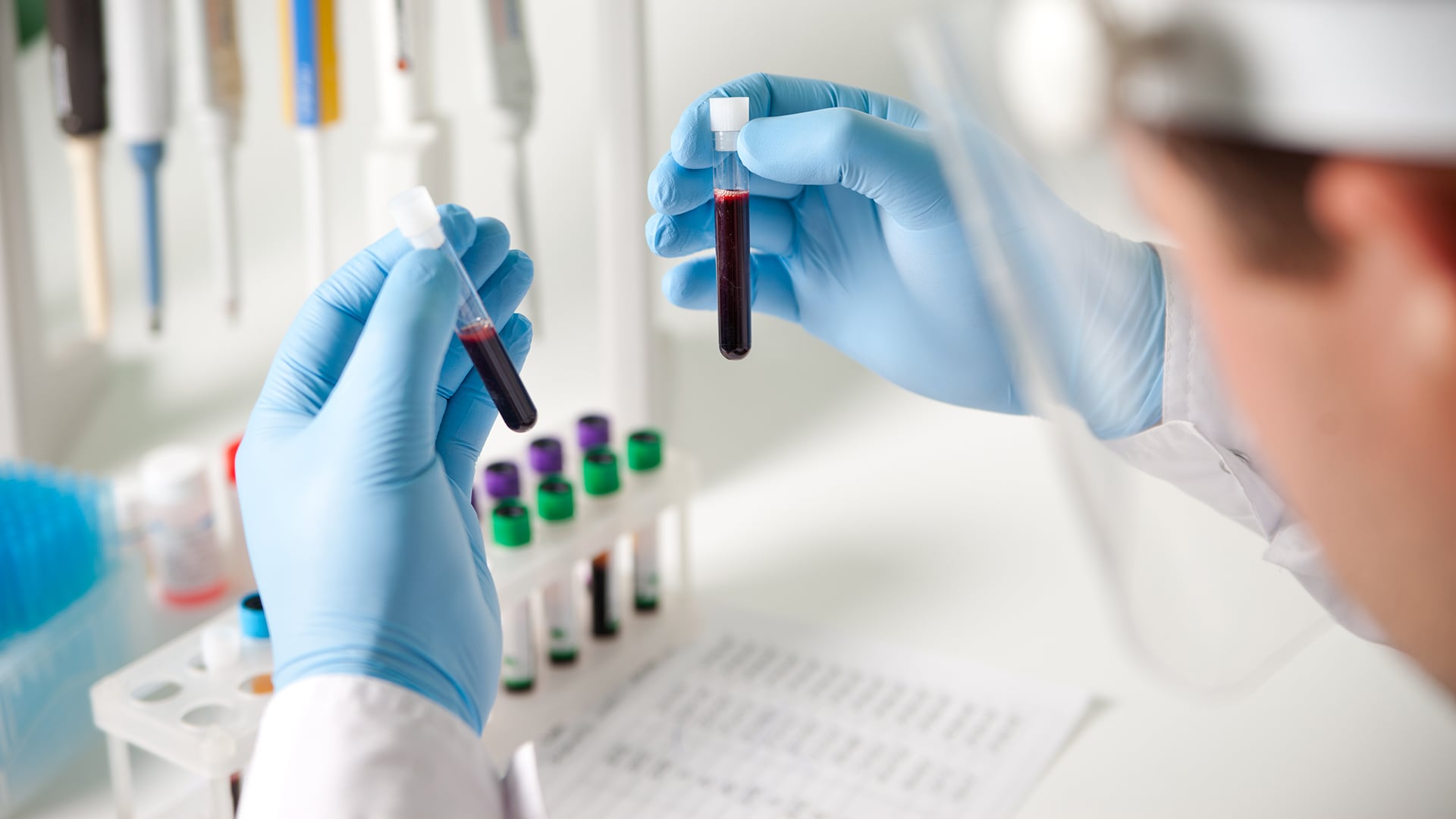 Sample Stability: How Time, Temperature, and Handling Influence Hematology Results