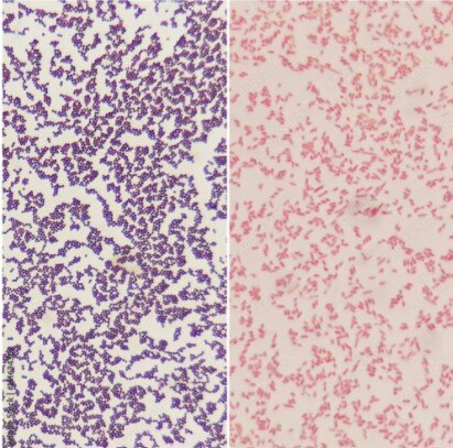 7 Tips to Stop False Gram-Negative Stains