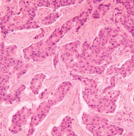 Hematoxylin