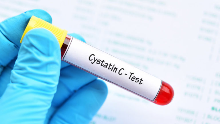 Cystain C Test tube