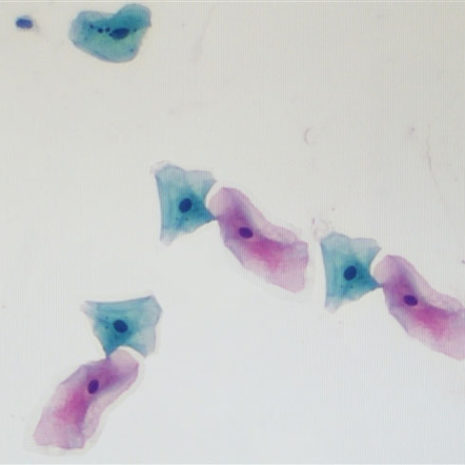 Papanicolaou Stain OG-6