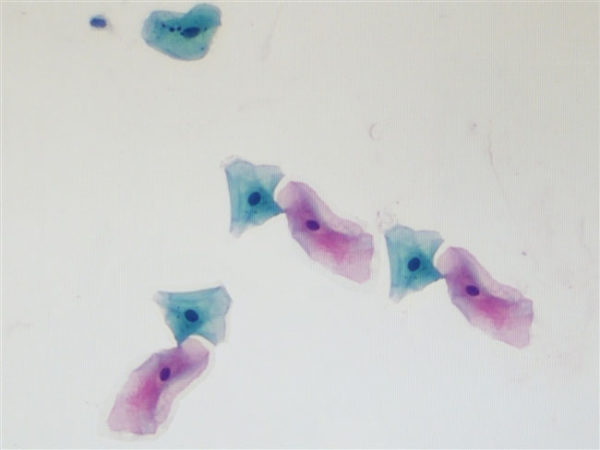 Papanicolaou Stain OG-6