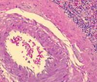 Hematoxylin Gill 3x