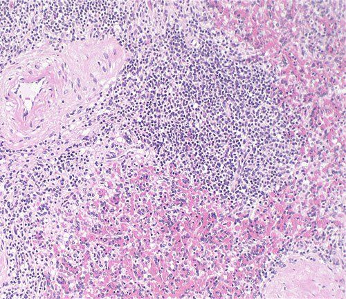 nuclear staining
