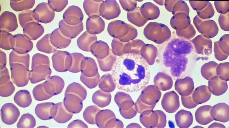 Improve The Definition & Intensity of a Wright’s or Wright-Giemsa Stain