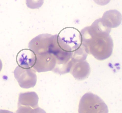 precipitate in hematology stains