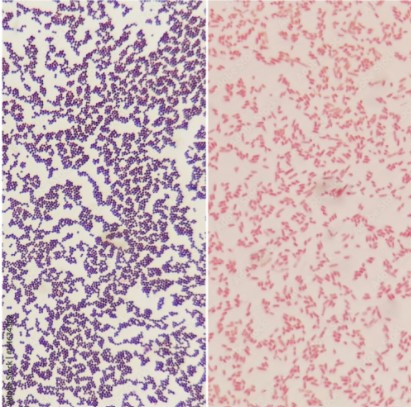 gram negative rods and gram positive cocci