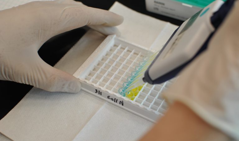 Choosing the Right ELISA