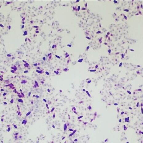 acid fast stain