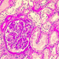 Tissue specimen stained with Astral Diagnostics Periodic Acid