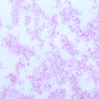 Tissue specimen stained with Astral Diagnostics Safranin