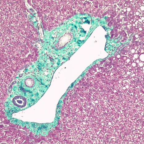 Tissue specimen stained with Astral Diagnostics Gomori Trichrome
